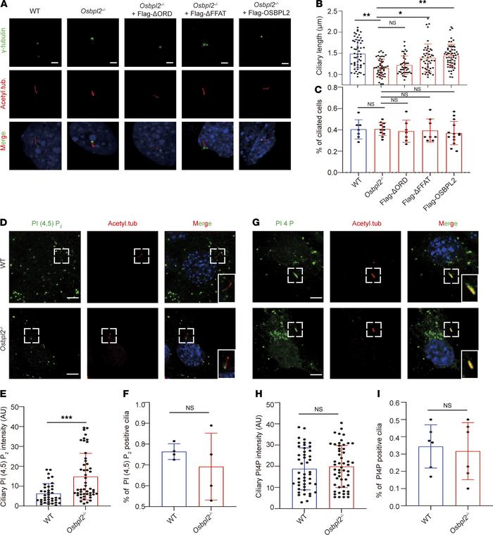 OSBPL2 regulated ciliogenesis by maintaining PI homeostasis on the cilia...