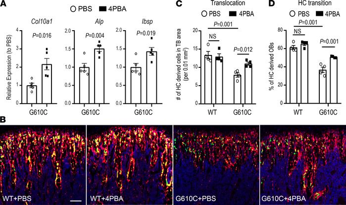 4PBA treatment improves translocation and osteoblastic transition of hyp...