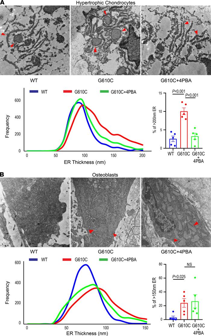 4PBA treatment improves ER dilation in hypertrophic chondrocytes but to ...