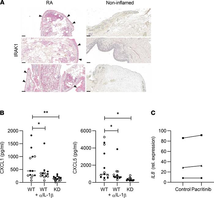 IRAK1 is essential for induction of neutrophil chemoattractants by RA sy...