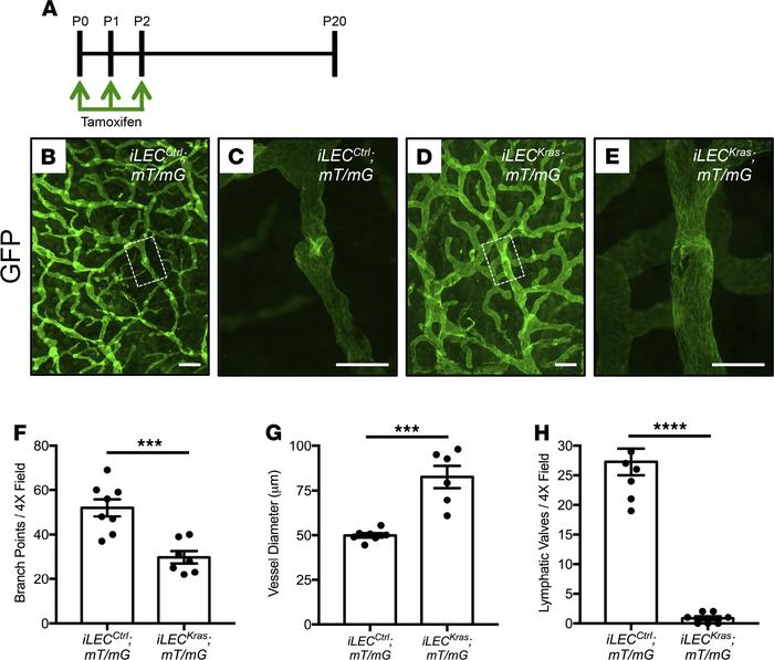 
iLECKras mice have fewer lymphatic valves compared with iLECCtrl mice.
...