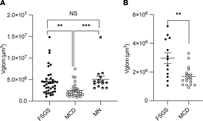 Glomerular morphometry shows significantly lower Vglom in MCD versus FSG...