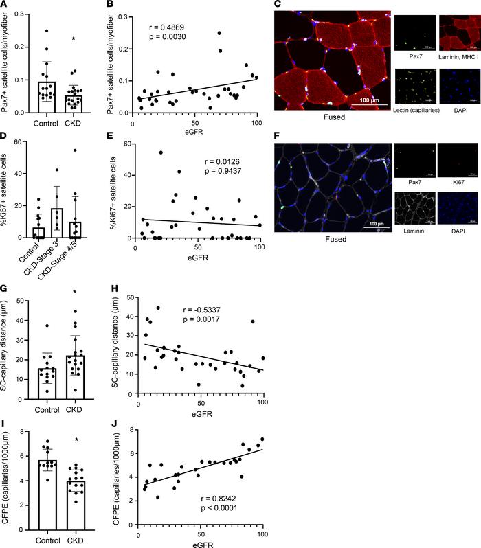 Satellite cell abundance, proximity of satellite cells to capillaries, a...