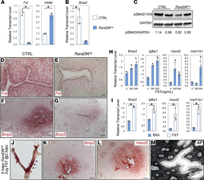 Reduced follistatin expression and downstream changes in activin/BMP sig...