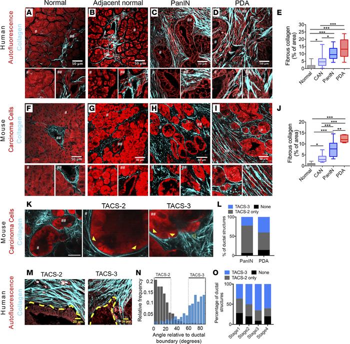 Fibrous collagen architectures in PDA.
(A–D) Combined MPE and SHG imagin...