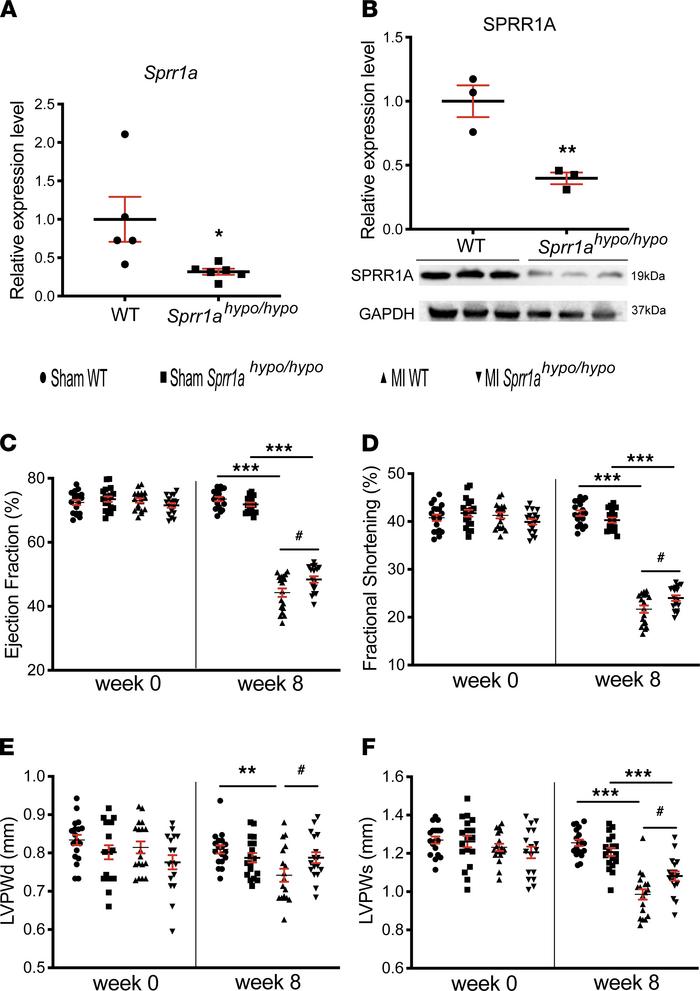Knockdown of Sprr1a protects the mouse heart against MI.
(A) qPCR expres...