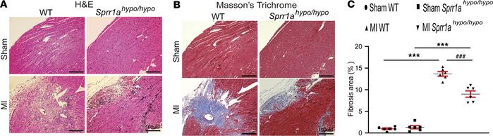 Downregulation of Sprr1a in mice reduces cardiac stress and fibrosis aft...