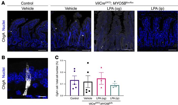 Lack of changes in the frequency of enteroendocrine cells in MYO5B-defic...