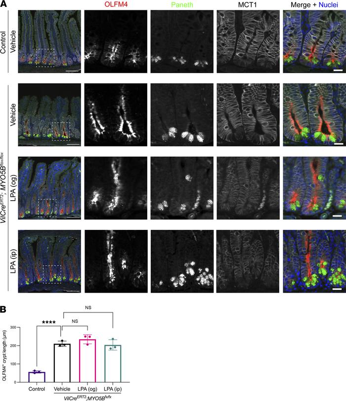 Changes in immunostaining pattern for OLFM4 and MCT1 induced by MYO5B lo...
