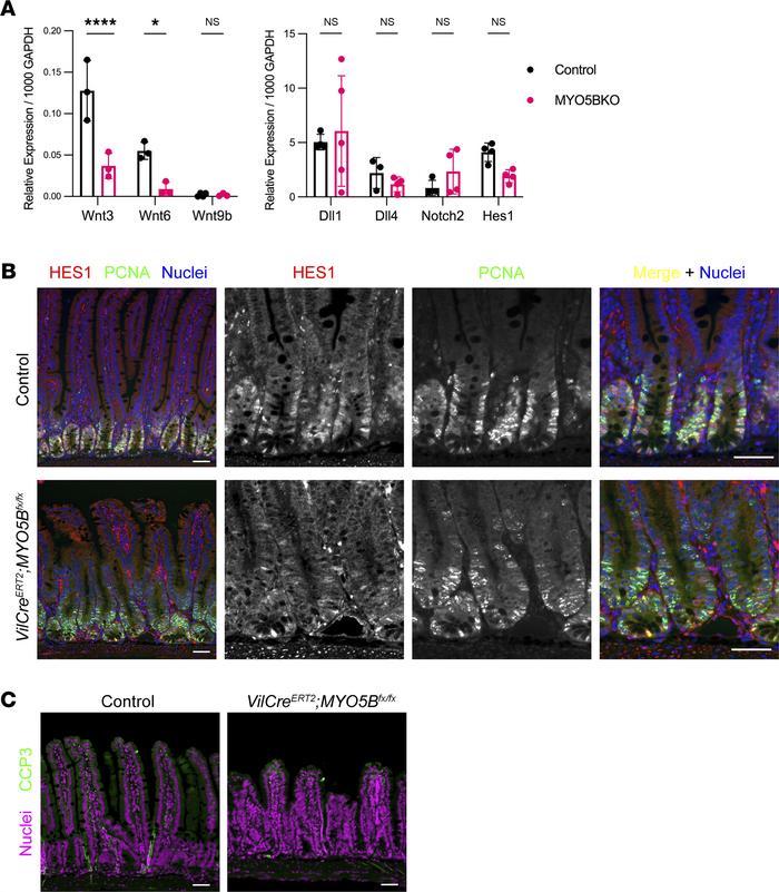 Alteration in the balance of Wnt/Notch signaling induced by MYO5B loss.
...