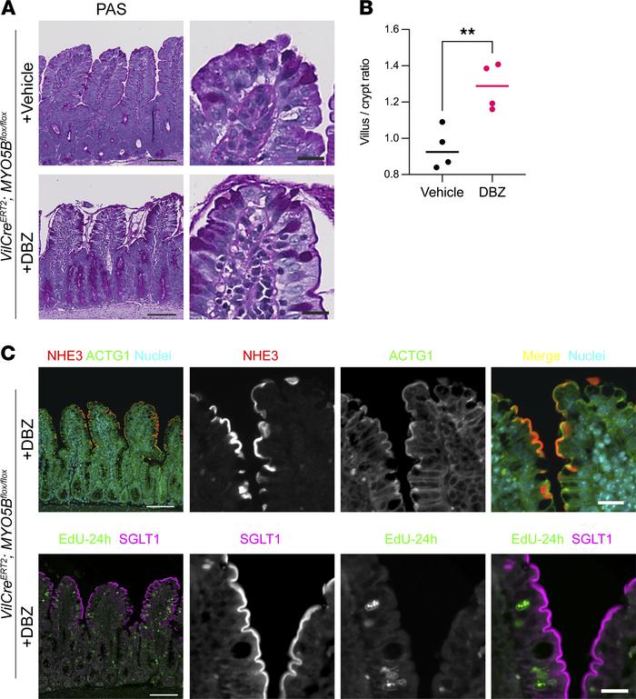 DBZ treatment improved enterocyte differentiation in tamoxifen-induced M...