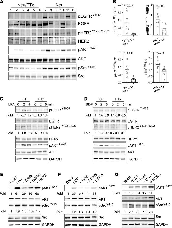 Gi/o-GPCRs induce transactivation of EGFR and HER2 in mammary tumor cell...