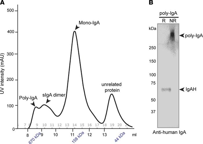 Plasma from patients with IgAN contains poly-IgA complexes that are susc...