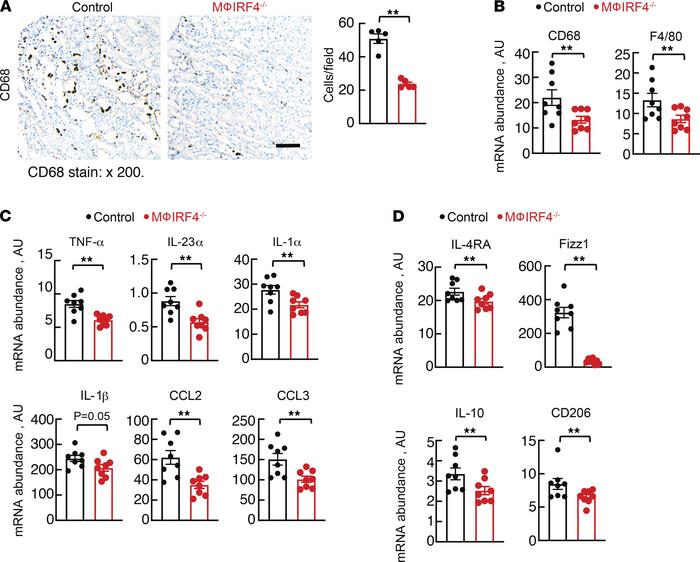 Chronic AA effects on kidney macrophage phenotype.
(A) Renal CD68 protei...