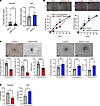 In vitro angiogenesis assays using SNHG12 gain- and loss-of-function models