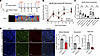 Knockdown of Snhg12 in a diabetic hind-limb ischemia model exacerbates neov