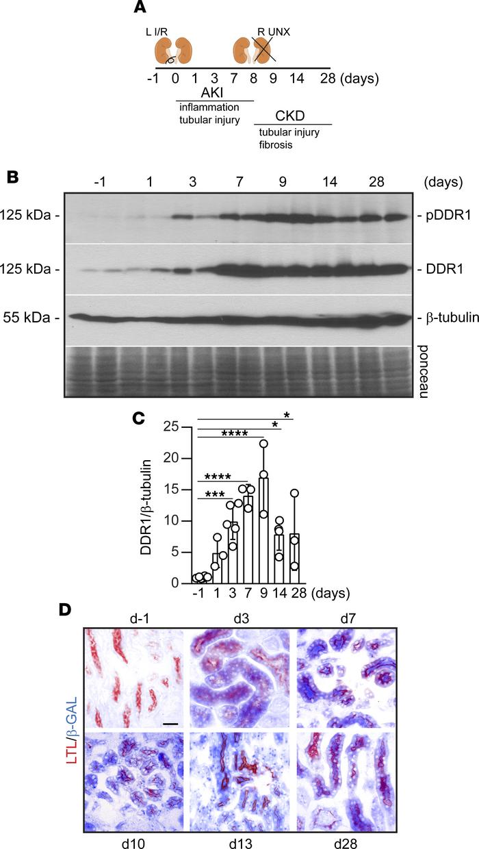 Increased DDR1 expression and activation after severe AKI that progresse...