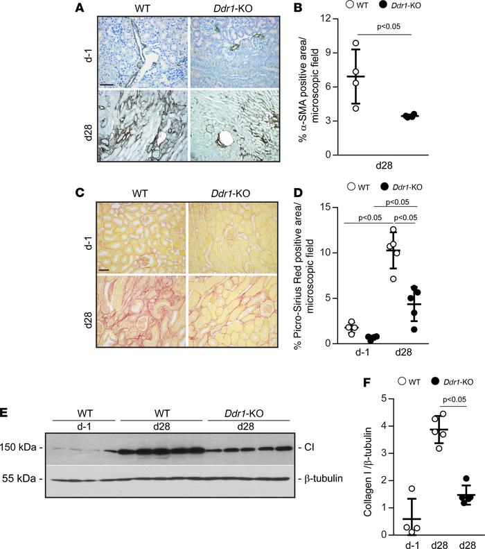 Decreased fibrosis in injured Ddr1-KO mice.
(A) Images of kidney section...