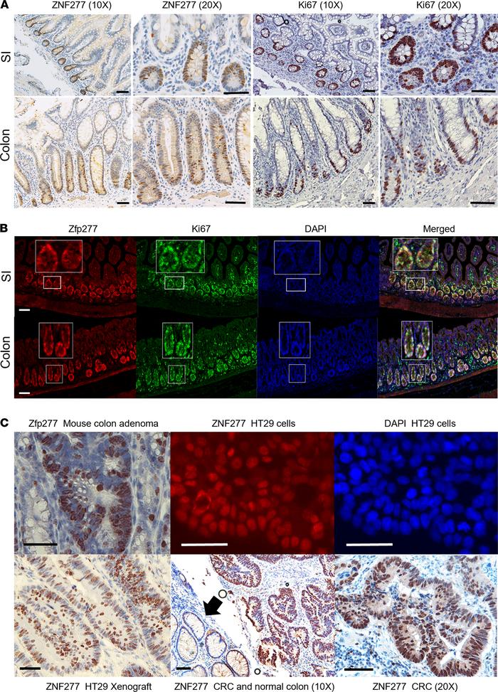 Expression and localization of ZNF277/Zfp277  in normal and neoplastic h...
