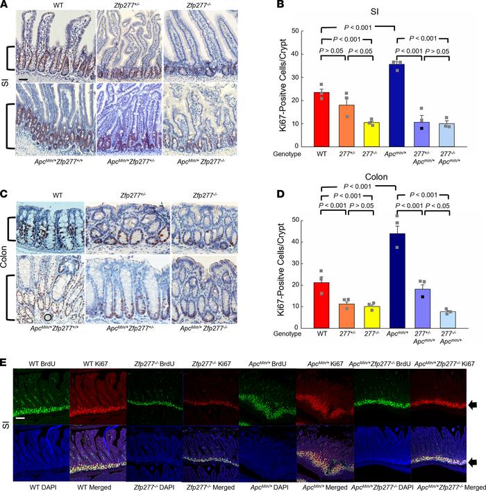 
Zfp277 deficiency attenuates epithelial cell proliferation in murine sm...