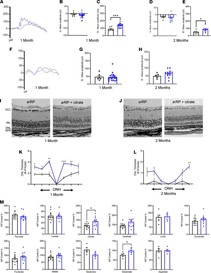 Citrate supplementation prolongs photoreceptor cell survival and visual ...
