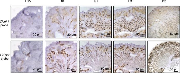 Spatiotemporal expression of Clc-k1 and Clc-k2 in the developing mouse k...