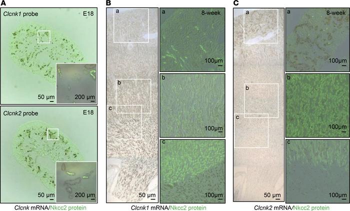 Localization of Clcnk1 and Clcnk2 mRNA transcripts in embryonic and adul...