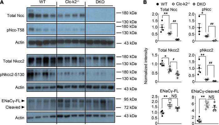 Comparison of Ncc, Nkcc2, and ENaC protein abundance in 2-week-old WT, C...