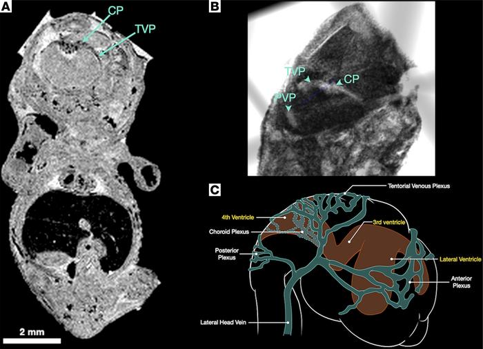 Tentorial venous plexus in the E14. 5 embryo.
(A and B) 2D raw data and ...