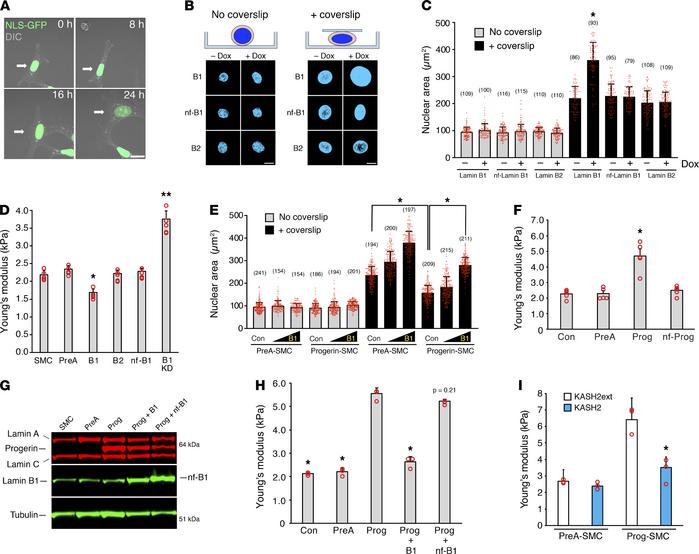 Lamin B1 decreases nuclear stiffness.
(A) Microscopy images of a live SM...