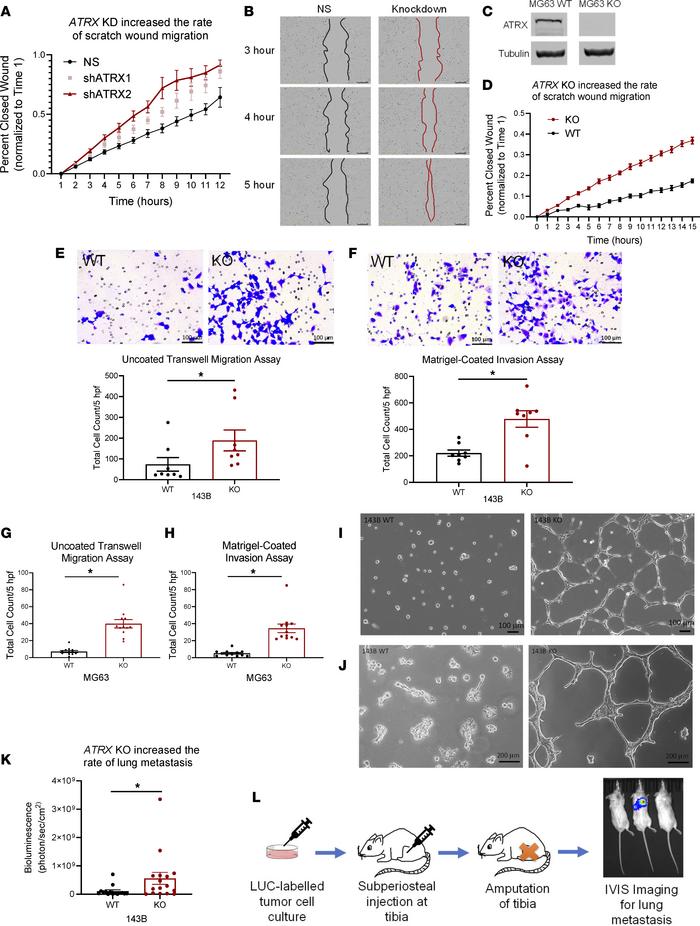 Tumor migration, invasion, and rate of metastasis increase with loss of ...