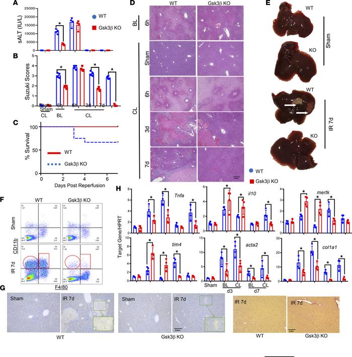 Myeloid Gsk3β regulates the resolution function of iMΦs in liver IRI.
My...