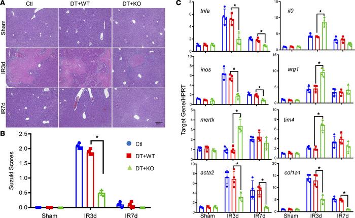 Gsk3β regulates BMMs in the resolution of liver IRI.
CD11b-DTR mice were...