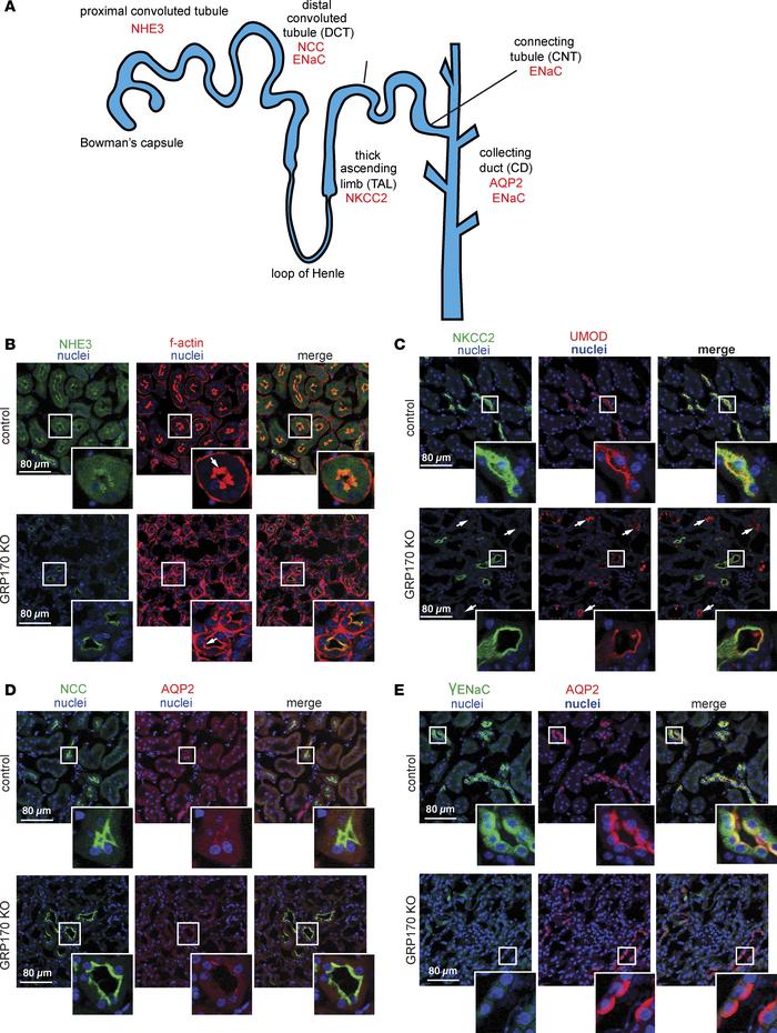Expression of ion channels and transporters in the GRP170-KO mouse.
(A–E...
