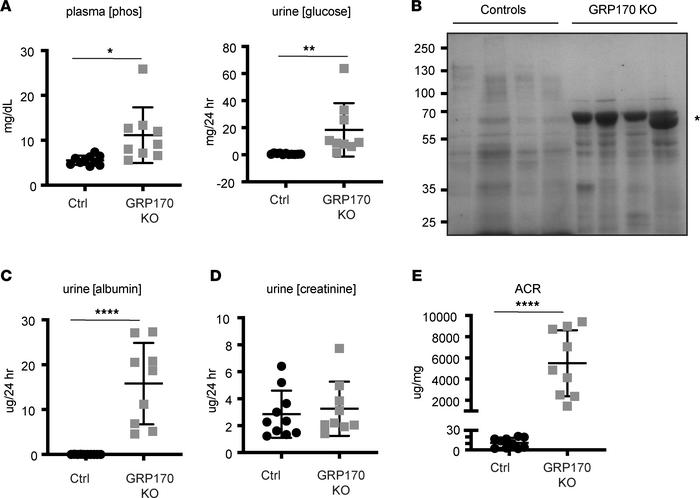 GRP170-KO mice exhibit characteristics of proximal tubule injury.
(A) Pl...