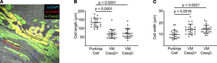 Juxta-Purkinje ventricular myocytes expressing cardiac Casq2 are morphom...