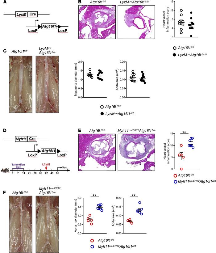 Specific deletion of Atg16l1 in smooth muscle cells increases the severi...