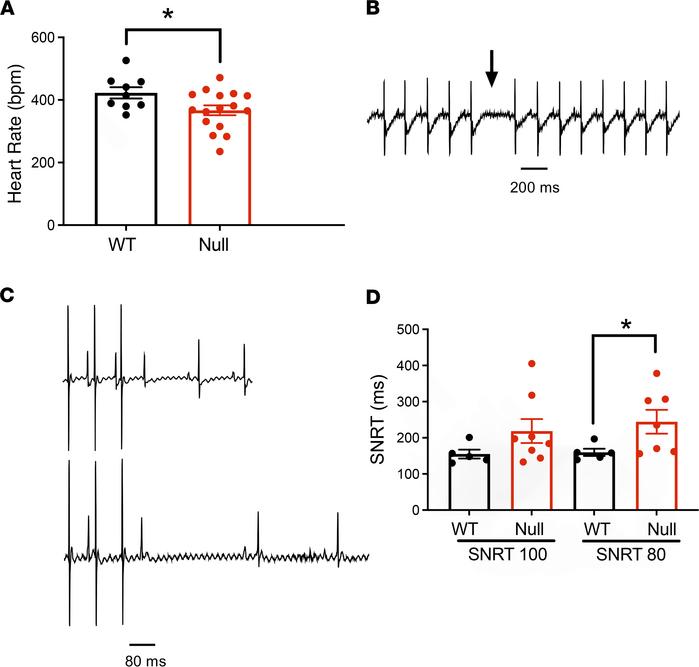Neonatal Scn1b-null mice exhibit SAN dysregulation.
(A) Comparison of he...