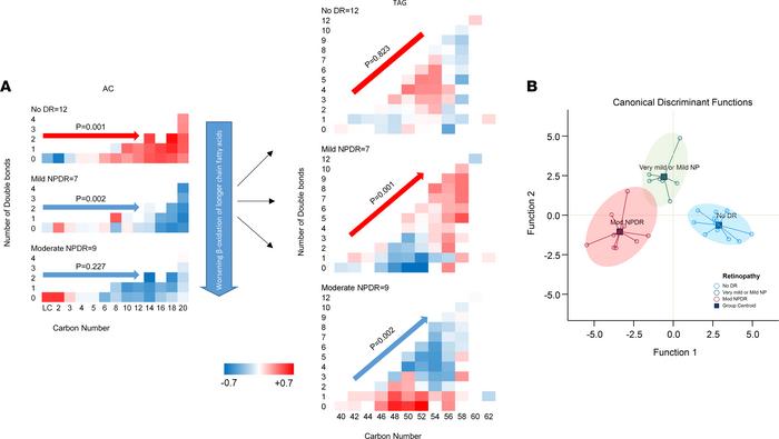 Comparing circulating lipids by diabetic retinopathy status.
(A) Distrib...