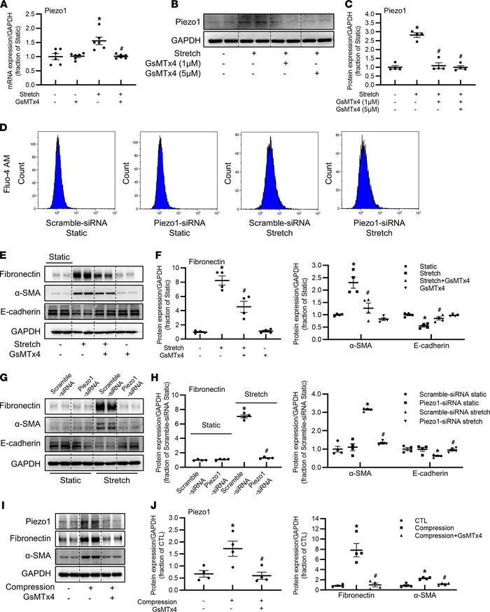 Piezo1 mediates mechanical stretch– or compression-induced profibrotic r...