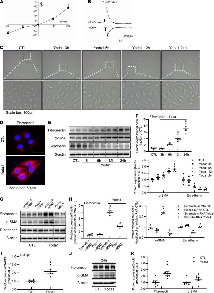 Activation of Piezo1 by an agonist, Yoda1, induces profibrotic responses...