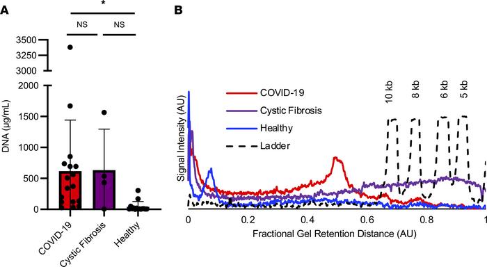 Increased levels of dsDNA in COVID-19 respiratory secretions.
(A) Quanti...