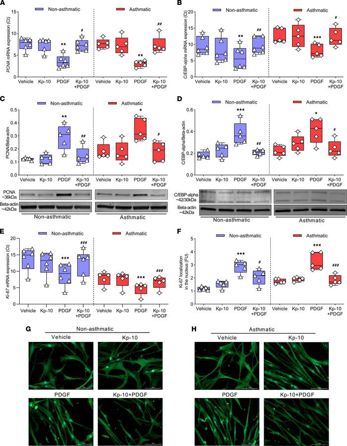Effect of Kp-10 on PDGF-induced human ASM cell proliferative marker prot...