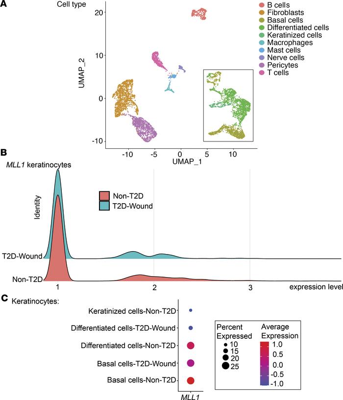 scRNA-Seq of Mll1 expression is decreased in human T2D wounds.
(A) Clust...