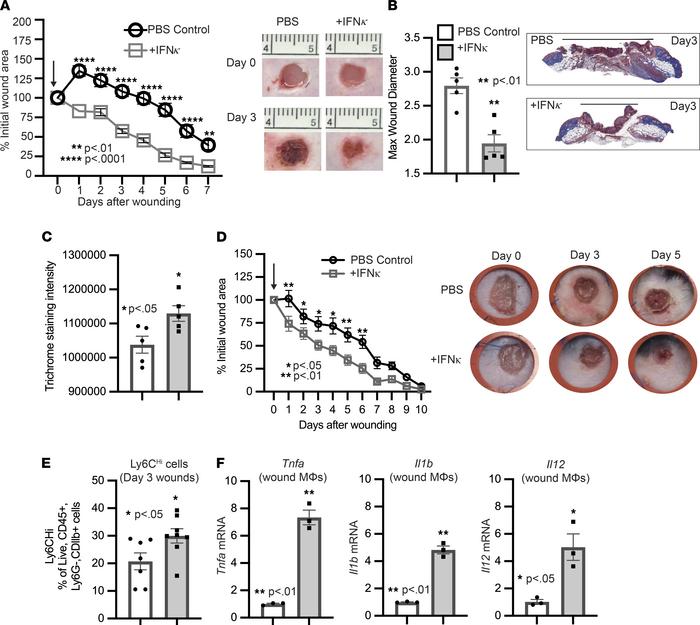 Administration of IFN-κ improves diabetic wound healing.
(A) The 4 mm pu...