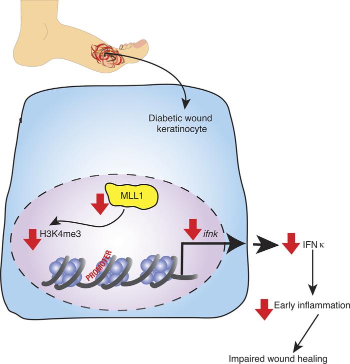 Schematic of IFN-κ regulation in diabetic wound keratinocytes.