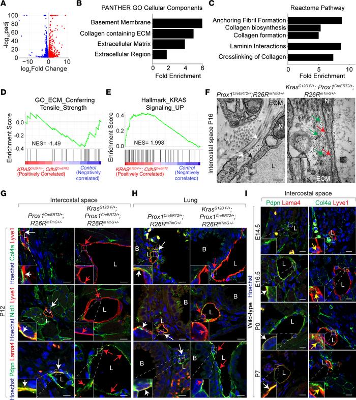 Pathological MAPK activation disrupts lymphatic basement membrane.
(A) V...