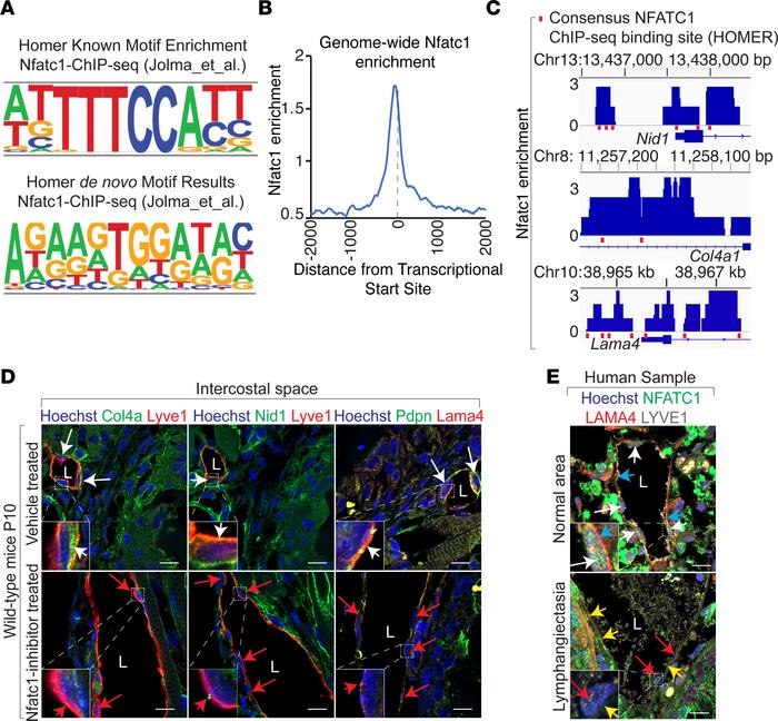 Pathological MAPK activation represses Nfatc1-dependent transcription of...