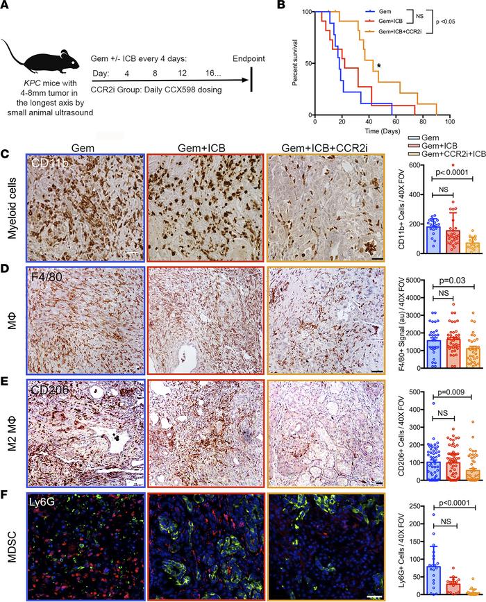 Blocking infiltration of bone marrow–derived TAMs increases responsivene...