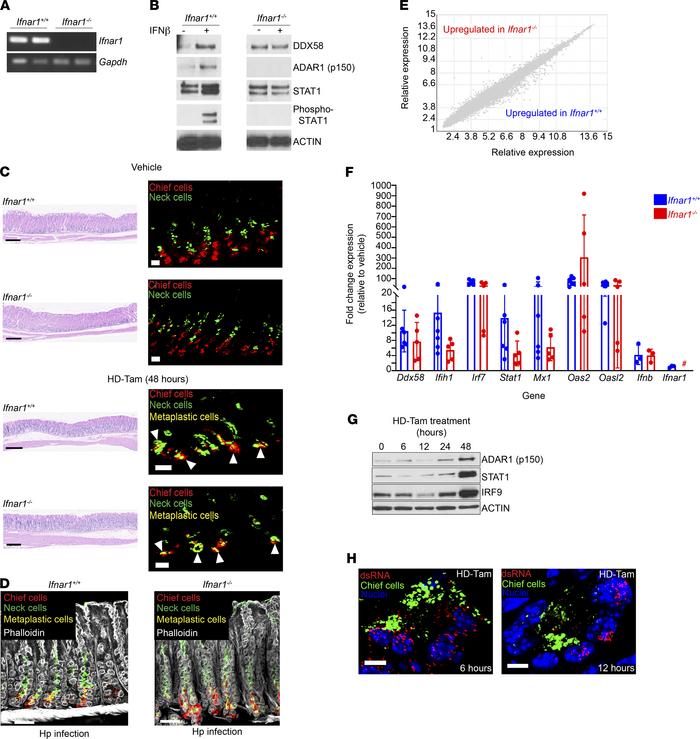 The dsRNA response during gastric metaplasia is independent of IFNAR1 si...
